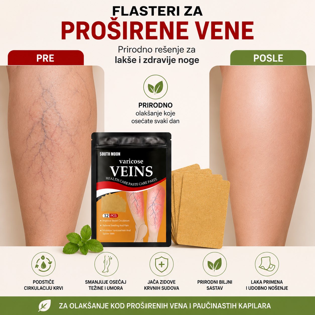 Varicose Veins